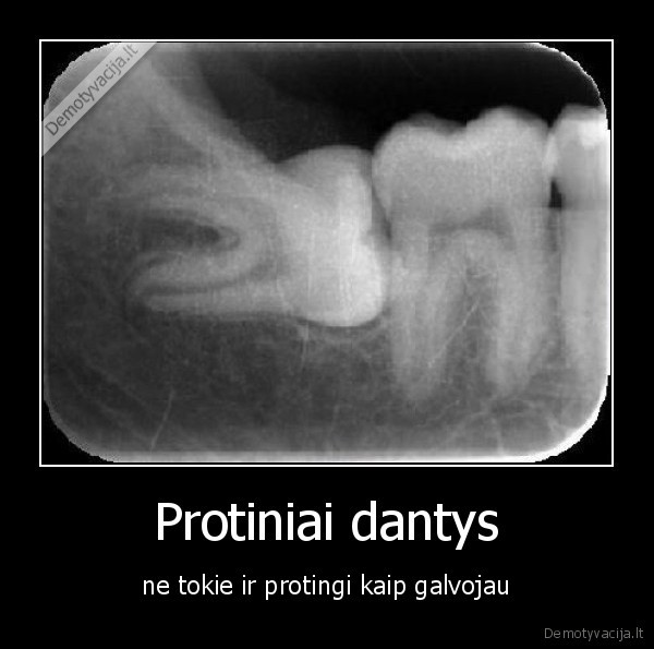 Protiniai dantys