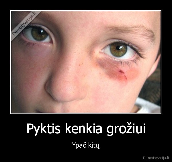 Pyktis kenkia grožiui