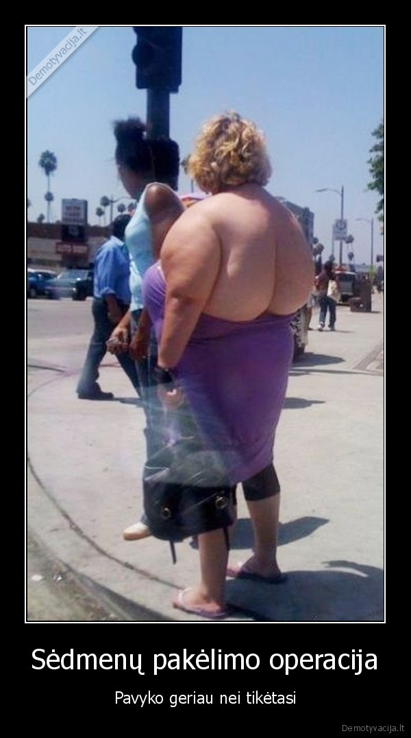 Sėdmenų pakėlimo operacija