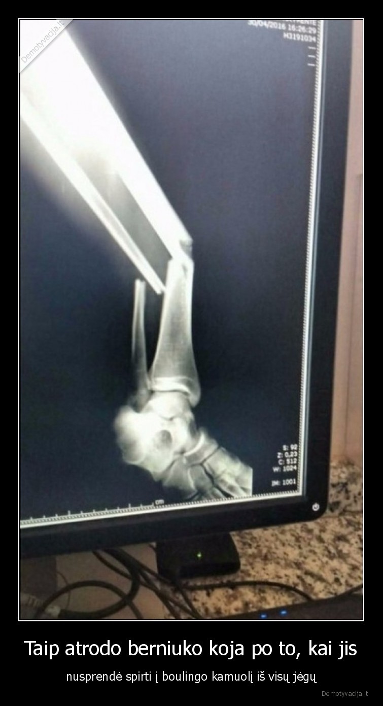 boulingas,luzo, koja