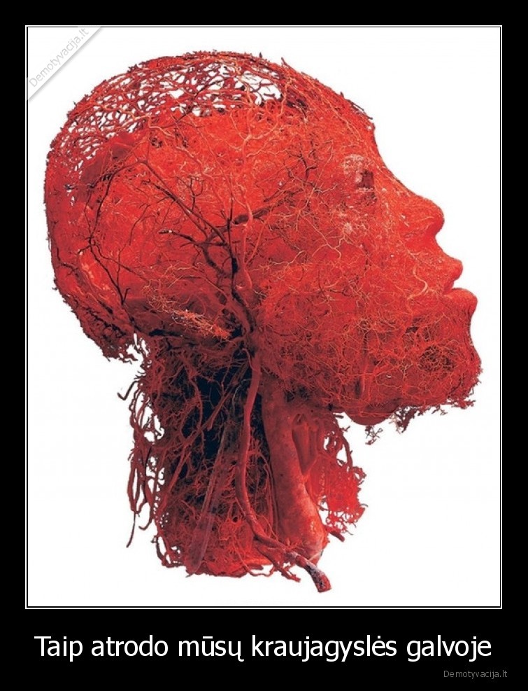 kraujagysles,galva,zmogus