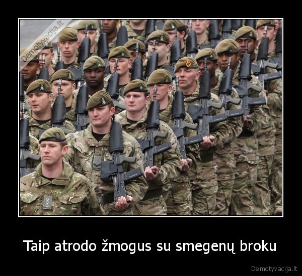 Taip atrodo žmogus su smegenų broku