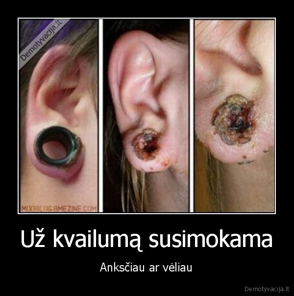 Už kvailumą susimokama