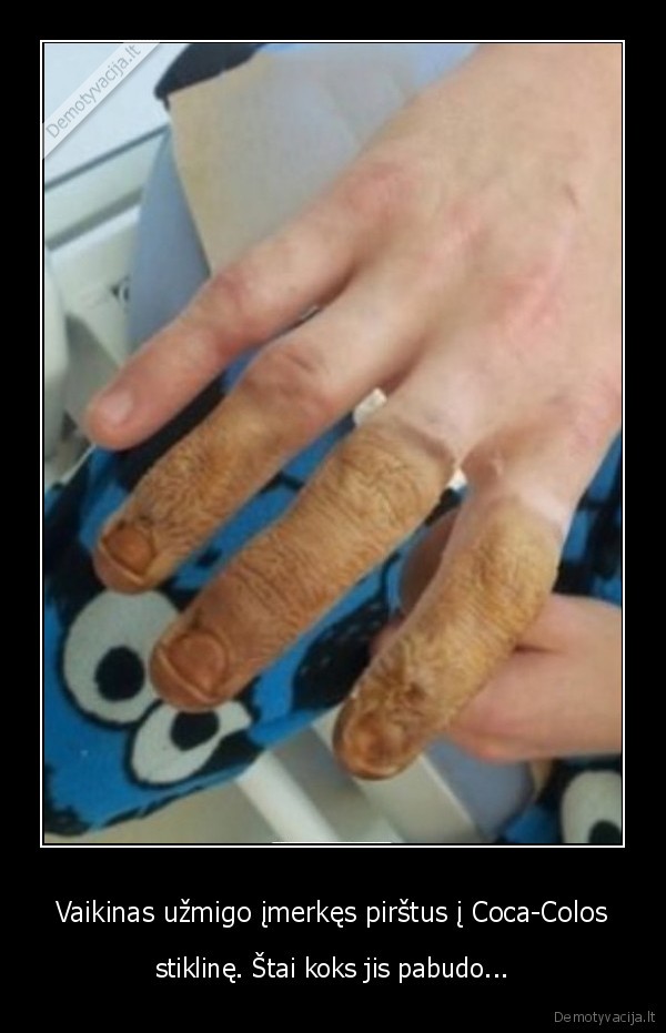 coca, cola,rudi, pirstai
