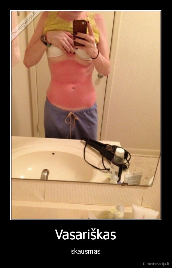 vasara,skausmas,degintis