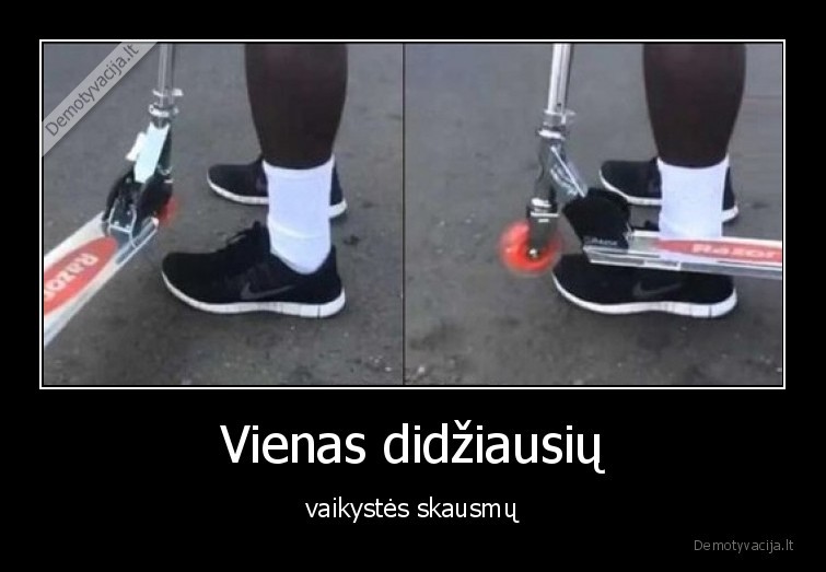 paspirtukas,i, koja,koja,skauda,vaikyste