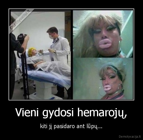 lupos,moterys,plastika