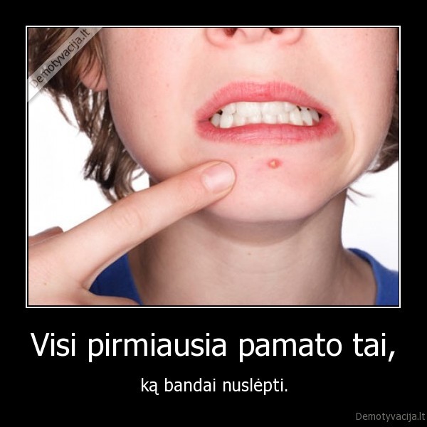 Visi pirmiausia pamato tai,