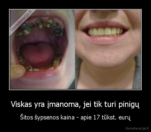 pinigai,ispuve, dantys,grazi, sypsena
