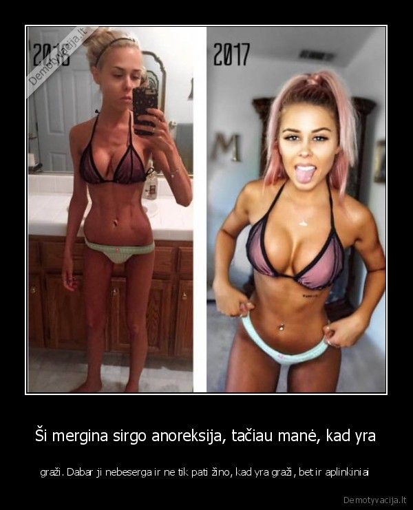 grazi, mergina,anoreksija