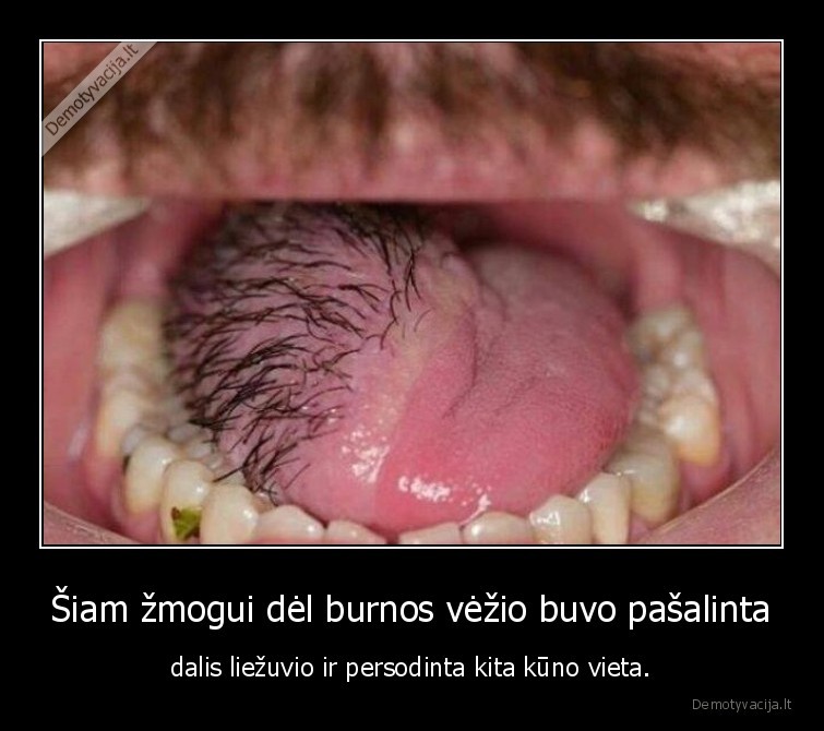 liezuvis,burnos, vezys,wtf