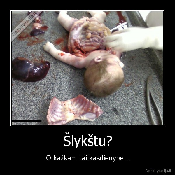 vaikas,darbas,mirtis,skrodimas,autopsija,gydytojas,bieber,kaunas