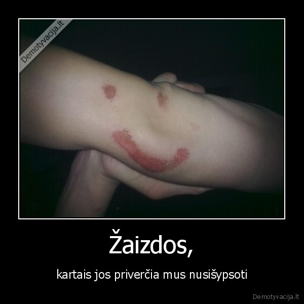 zaizdos,zaizda,ranka,rankos