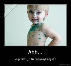 Ahh... - kaip niežti, o tu pasikasyt negali !