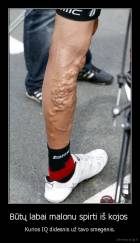 Būtų labai malonu spirti iš kojos  - Kurios IQ didesnis už tavo smegenis.