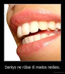 Dantys ne rūbai iš mados neišeis. - 