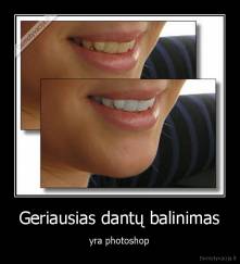 Geriausias dantų balinimas - yra photoshop