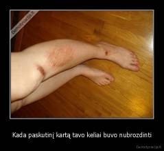 Kada paskutinį kartą tavo keliai buvo nubrozdinti - 