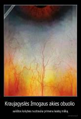 Kraujagyslės žmogaus akies obuolio  - aukštos kokybės nuotrauka primena keistą mišką
