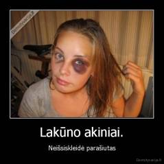 Lakūno akiniai. - Neišsiskleidė parašiutas