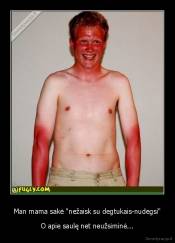 Man mama sakė "nežaisk su degtukais-nudegsi" - O apie saulę net neužsiminė...