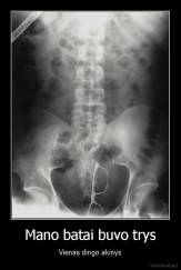 Mano batai buvo trys - Vienas dingo akinys