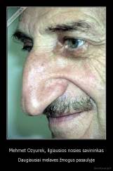 Mehmet Ozyurek, ilgiausios nosies savininkas - Daugiausiai melaves žmogus pasaulyje