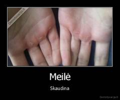 Meilė - Skaudina