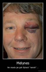 Mėlynes - Ne visada jas gali išplauti "vanish" ...