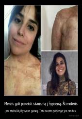 Menas gali pakeisti skausmą į šypseną. Ši moteris - per stebuklą išgyveno gaisrą. Tatuiruotės pridengė jos randus.