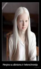 Mergina su albinizmu ir heterochromija  - 