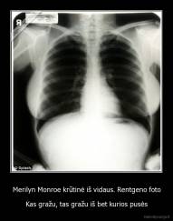 Merilyn Monroe krūtinė iš vidaus. Rentgeno foto - Kas gražu, tas gražu iš bet kurios pusės