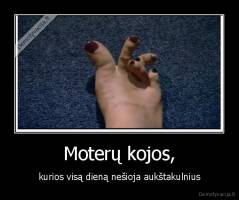 Moterų kojos, - kurios visą dieną nešioja aukštakulnius