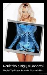 Neužteko pinigų silikonams? - Naujieji "Spaldingo" kamuoliai daro stebuklus. 