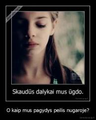 O kaip mus pagydys peilis nugaroje? - 