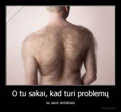 O tu sakai, kad turi problemų - su savo antakiais