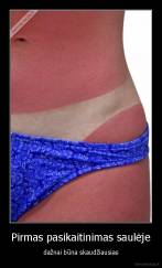 Pirmas pasikaitinimas saulėje - dažnai būna skaudžiausias