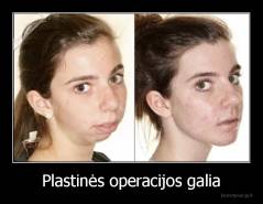 Plastinės operacijos galia - 