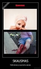 SKAUSMAS - Kiekvienas jį supranta savaip