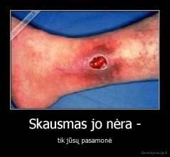 Skausmas jo nėra - - tik jūsų pasamonė