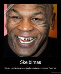 Skelbimas - Darau plastines operacijas be narkozės. Mike'as Tysonas.