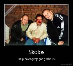 Skolos - Kaip palengvėja jas gražinus