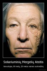 Soliariuminių Mergelių Ateitis - Vairuotojas, 69 metų, 28 metus vairavo sunkvežimį