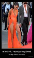 Tai nenormalu! Kaip taip galima pasirodyti  - viešumoje? Tas bičas neturi kojinių!