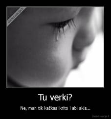 Tu verki? - Ne, man tik kažkas ikrito i abi akis...