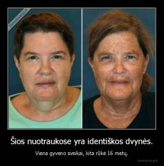 Šios nuotraukose yra identiškos dvynės. - Viena gyveno sveikai, kita rūkė 16 metų.