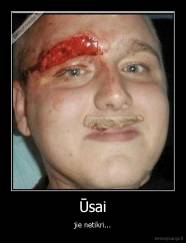 Ūsai - jie netikri...