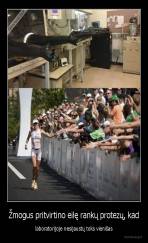 Žmogus pritvirtino eilę rankų protezų, kad - laboratorijoje nesijaustų toks vienišas